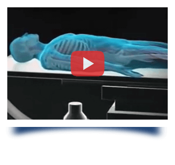 coronary-angiography