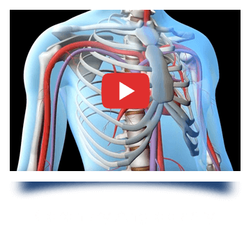 coronary-angioplasty